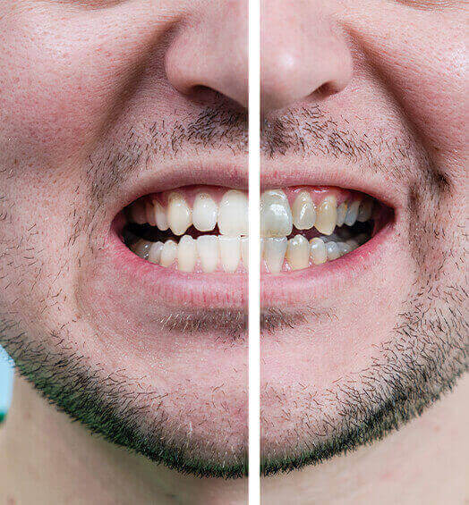orthodontics (1) (1) (1) (1)