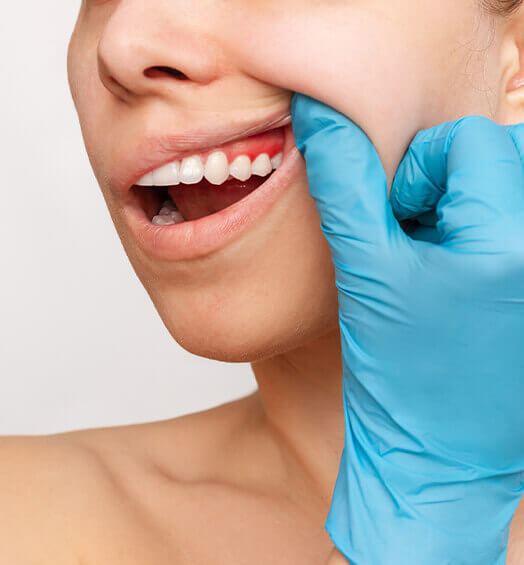 soft tissue management (non surgical approach to gum disease) (1)